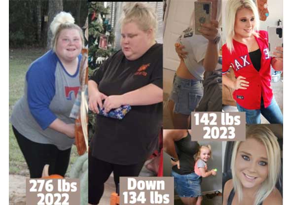 Taylor's before and after weight loss surgery